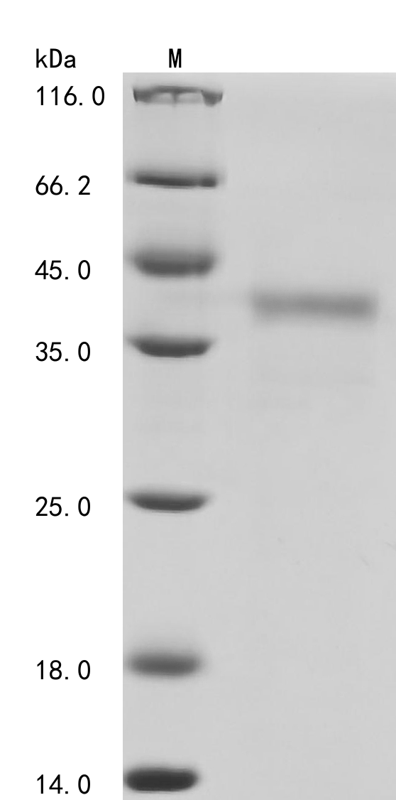 SDS-PAGE