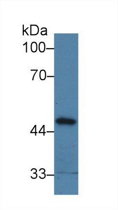 14257