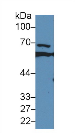 14606