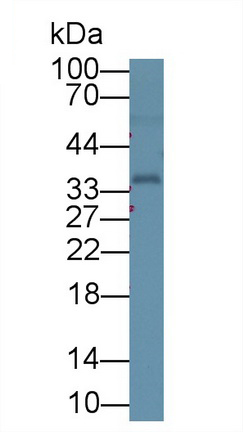 12851