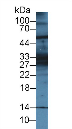 9921