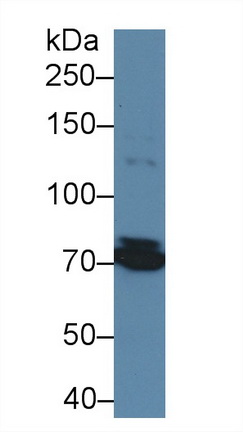 13559