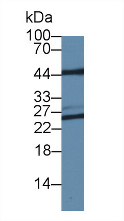 17705