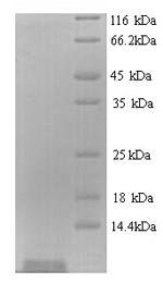 SDS-PAGE