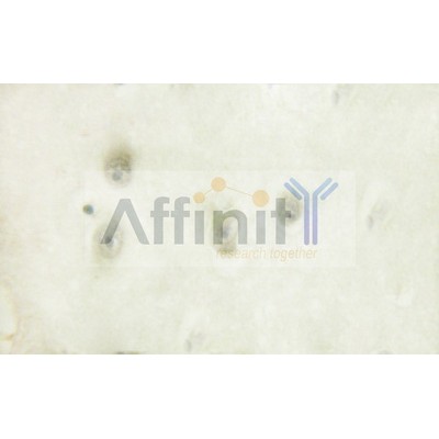 Валидация Affinity AF6163 - 3381