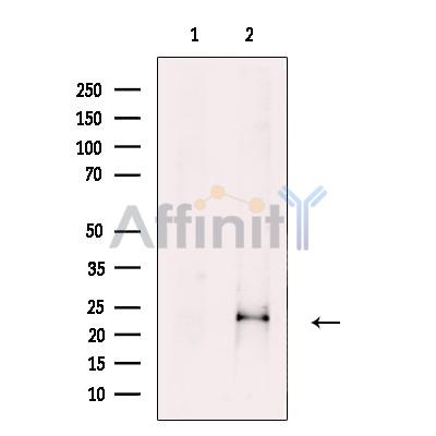 Валидация Affinity DF3595 - 14558