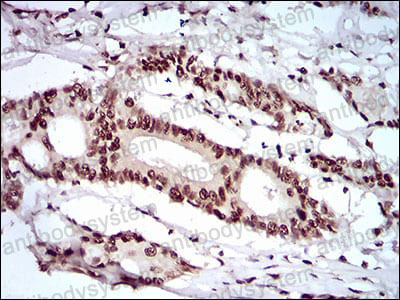Валидация AntibodySystem RHN93801