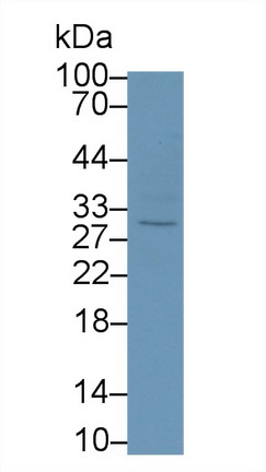 19242