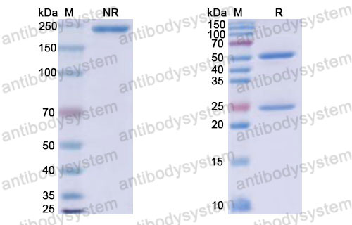 Валидация SDS-PAGE - AntibodySystem RHJ92819