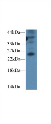 14561