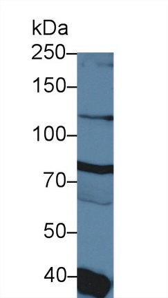 14209