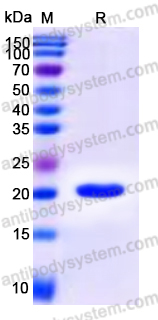 EHC16901, SDS-PAGE