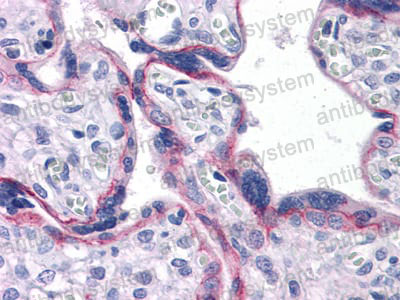 Валидация AntibodySystem RHD31902 (1483)