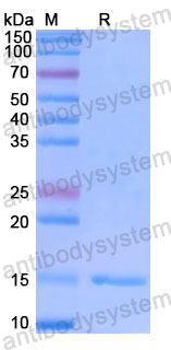 Валидация SDS-PAGE - AntibodySystem RHE65201