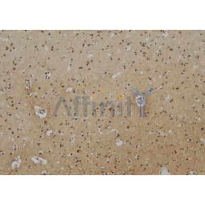 Валидация Affinity DF4046 - 15306