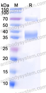 EHC84102, SDS-PAGE