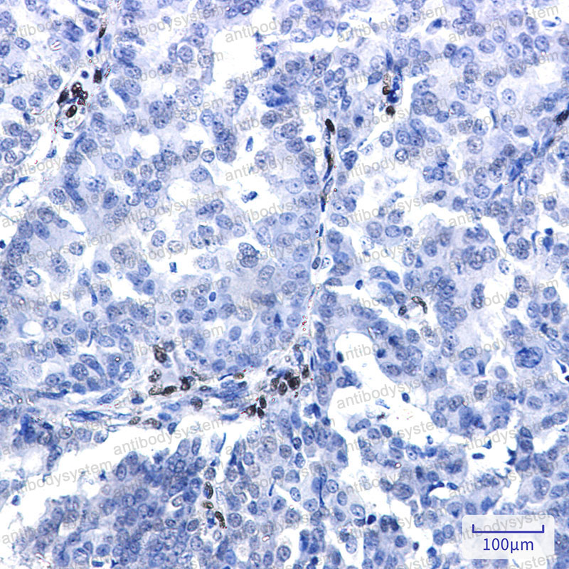 Валидация AntibodySystem RHD62801