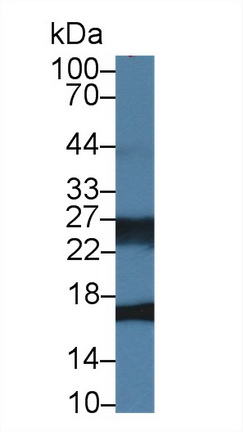 14309
