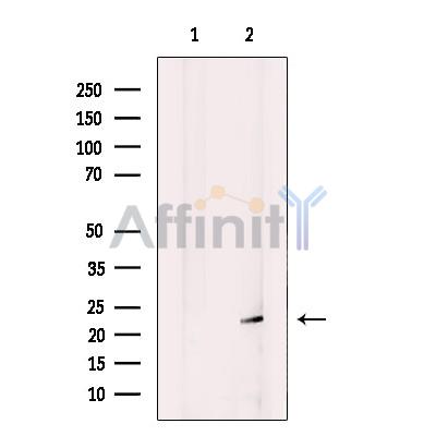 Валидация Affinity DF12379 - 6843