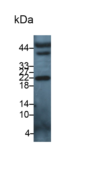 30815