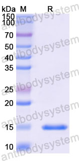 Валидация SDS-PAGE - AntibodySystem RHD80805