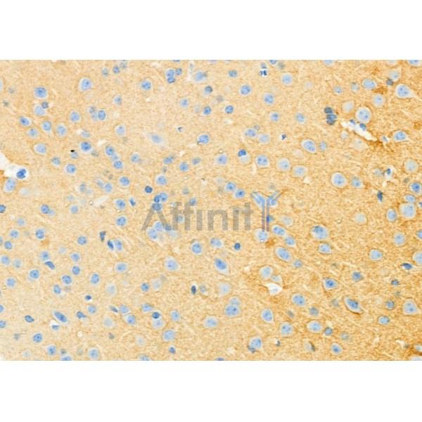 Валидация Affinity DF12461 - 7005