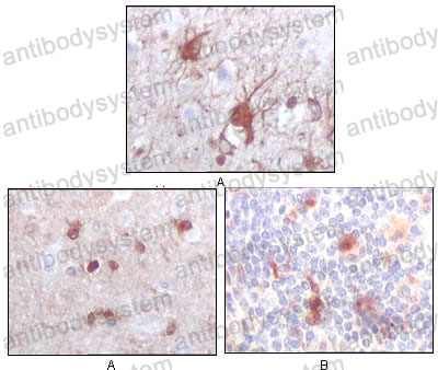 Валидация AntibodySystem RHC08406