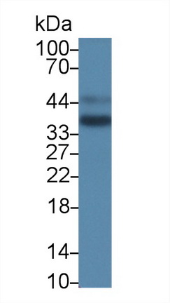 12771