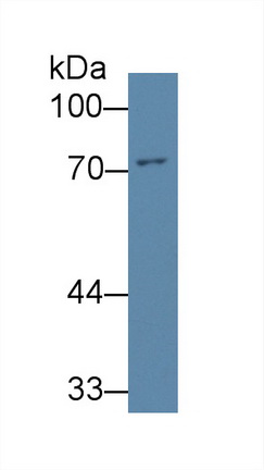 12527