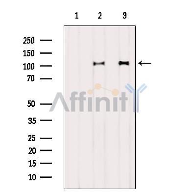 Валидация Affinity DF6107 - 17322