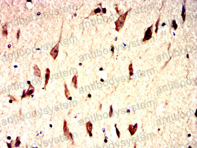 Валидация AntibodySystem RHN99101