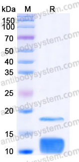 YHJ61302, SDS-PAGE