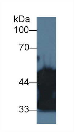 17623