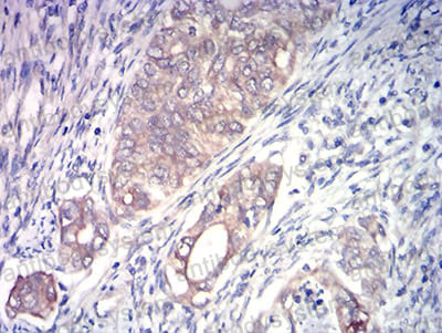 Валидация AntibodySystem RHJ98302