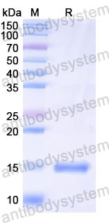 Валидация SDS-PAGE - AntibodySystem RMM03401