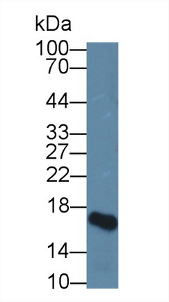 12367