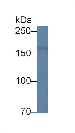 14179