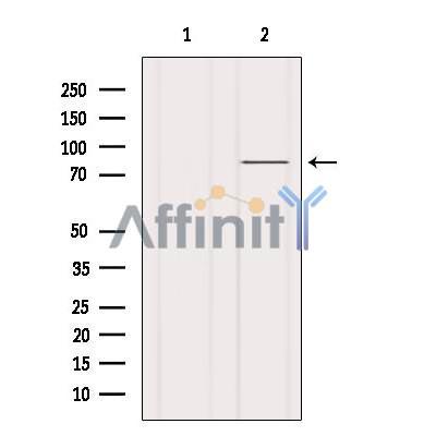 Валидация Affinity AF6241 - 3481