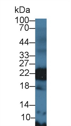 9548