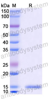 Валидация SDS-PAGE - AntibodySystem RCK81005