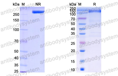 Валидация SDS-PAGE - AntibodySystem DHC15807