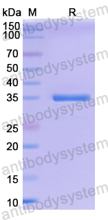 YVV16101, SDS-PAGE