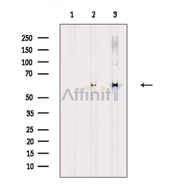 Валидация Affinity DF8657 - 20621