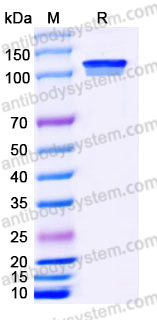 EHE57001, SDS-PAGE