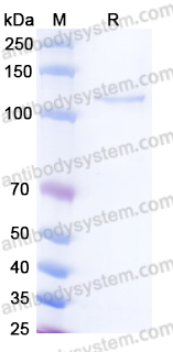 EHK55701, SDS-PAGE