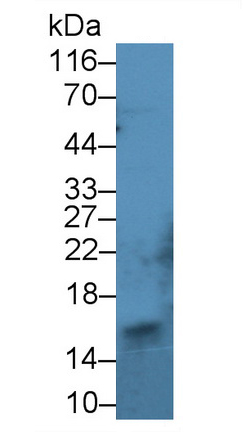14749