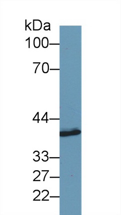 14528