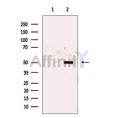Валидация Affinity DF13503 - 8892