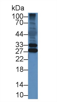 12921