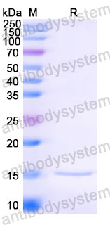 Валидация SDS-PAGE - AntibodySystem RVV03104